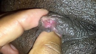 Camel toe